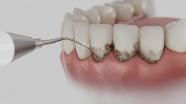 Reliable Dental Implants contractor in Moody AFB, GA by Smile Center Dentistry